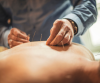Acupuncture Therapy