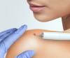 Wart Removal Therapy