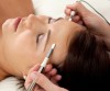 Cosmetic Acupuncture
