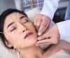 Cosmetic Acupuncture