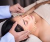 Cosmetic Acupuncture