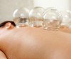 Wet, Dry & Fire Cupping Therapy