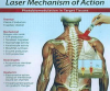 Laser Therapy